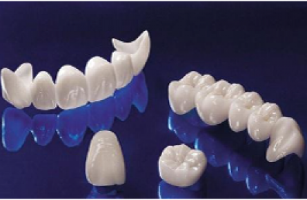 Qui trình làm răng toàn sứ cad/cam zirconia